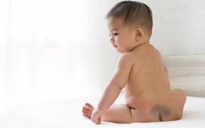 Você já ouviu falar em Mancha Mongólica?
